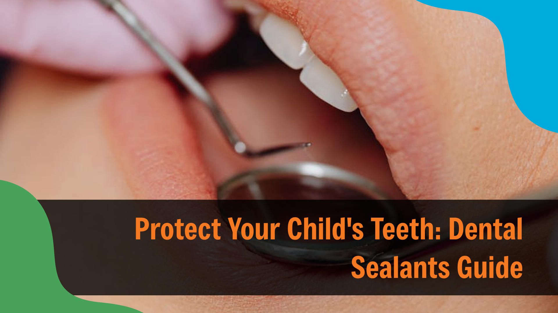 Protect Your Child’s Teeth_ Dental Sealants Guide Close-up of a dentist applying treatment to a child’s teeth using dental tools, with text reading “Protect Your Child’s Teeth: Dental Sealants Guide,” emphasizing preventive care for cavities.